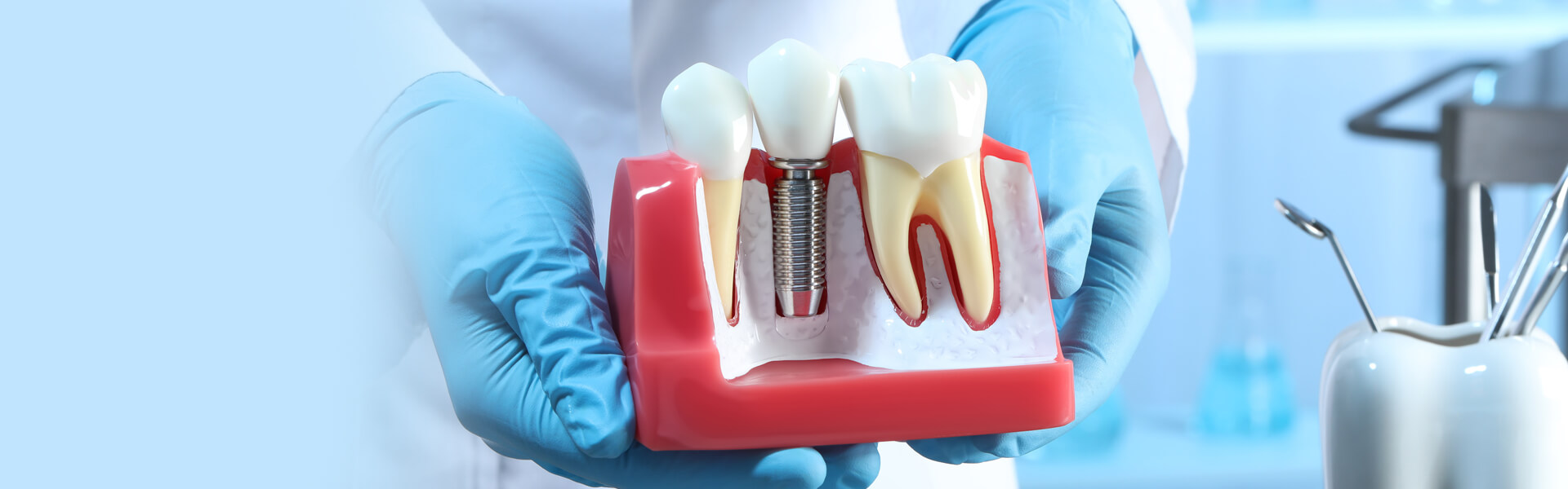Dental Implants in Forty Fort, PA